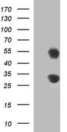 HEK293T cells were transfected with the pCMV6-ENTRY control (Left lane) or pCMV6-ENTRY GADD45A (Right lane) cDNA for 48 hrs and lysed. Equivalent amounts of cell lysates (5 ug per lane) were separated by SDS-PAGE and immunoblotted with anti-GADD45A.