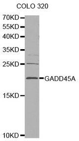 Western blot analysis of extracts of COLO 320 cells tissue, using GADD45A antibody.