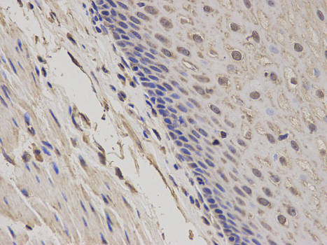 Immunohistochemistry of paraffin-embedded human esophagus using GADD45A antibody at dilution of 1:100 (400x lens).