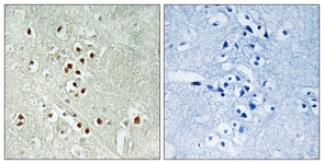 IHC of paraffin-embedded human brain, using GADD45GIP1 Antibody. The picture on the right is treated with the synthesized peptide.