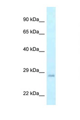 GADD45GIP1 antibody LS-C145786 Western blot of HeLa Cell lysate. Antibody concentration 1 ug/ml.