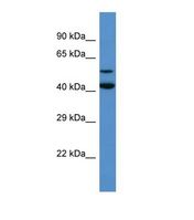 Western blot of Human HeLa. GADL1 antibody dilution 1.0 ug/ml.