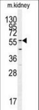 Western blot of GADL1 antibody in mouse kidney tissue lysates (35 ug/lane). GADL1 (arrow) was detected using the purified antibody.