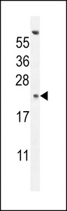 GAGE13 Antibody western blot of K562 cell line lysates (35 ug/lane). The GAGE13 antibody detected the GAGE13 protein (arrow).