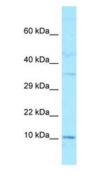 GAGE2A antibody Western Blot of MDA-MB-435S cell lysate.