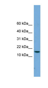 PAGE4 antibody LS-C116206 Western blot of Jurkat lysate.