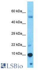 GAGEC1 / JM27 antibody Western Blot of Thymus Tumor. Antibody dilution: 1 ug/ml.