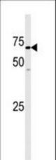 Western blot of anti-hGAK-G30 antibody in mouse heart tissue lysate. hGAK-G30(arrow) was detected using the purified antibody.