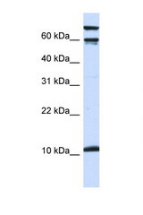 GAL / Galanin antibody LS-C102840 Western blot of 293T Cell lysate. Antibody concentration 1 ug/ml.