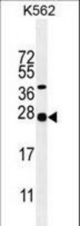 GAL Antibody western blot of K562 cell line lysates (35 ug/lane). The GAL antibody detected the GAL protein (arrow).