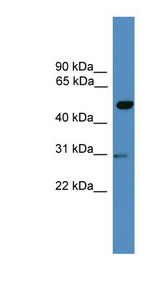 GAL3ST3 antibody LS-C116866 Western blot of MCF7 cell lysate.