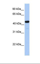 Fetal liver lysate. Antibody concentration: 1.0 ug/ml. Gel concentration: 12%.