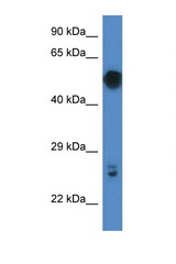GAL3ST4 antibody LS-C145385 Western blot of Mouse Pancreas lysate. Antibody concentration 1 ug/ml.