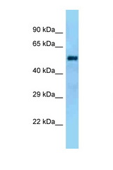 GAL3ST4 antibody LS-C146413 Western blot of Rat Liver lysate. Antibody concentration 1 ug/ml.