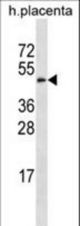 GAL3ST4 Antibody western blot of human placenta tissue lysates (35 ug/lane). The GAL3ST4 antibody detected the GAL3ST4 protein (arrow).
