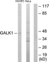 Western blot of extracts from HUVEC/HeLa cells, using GALK1 Antibody. The lane on the right is treated with the synthesized peptide.
