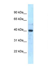 GALK1 antibody LS-C145875 Western blot of Fetal Liver lysate. Antibody concentration 1 ug/ml.