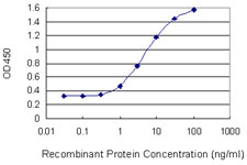 Detection limit for recombinant GST tagged GALK1 is 0.3 ng/ml as a capture antibody.