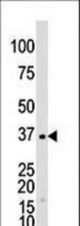 The anti-GALK1 antibody is used in Western blot to detect GALK1 in Y79 cell lysate.
