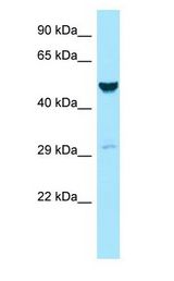 GALK2 antibody Western Blot of MCF7.