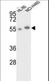 Western blot of hGALK2-M1 in HL-60, NCI-H460 cell line lysates (35 ug/lane). GALK2 (arrow) was detected using the purified antibody.