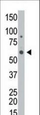 The anti-GALK2 antibody is used in Western blot to detect GALK2 in HL-60 cell lysate.