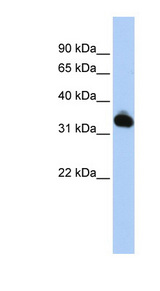 GALM antibody LS-C102444 Western blot of HepG2 cell lysate.