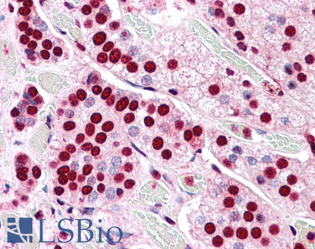 Anti-COMT antibody LS-A8833 IHC of human adrenal. Immunohistochemistry of formalin-fixed, paraffin-embedded tissue after heat-induced antigen retrieval.