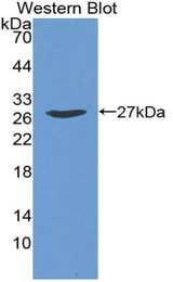 Western blot of recombinant GALNS / Chondroitinase.