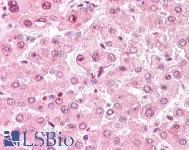 Anti-COMT antibody LS-A8836 IHC of human liver. Immunohistochemistry of formalin-fixed, paraffin-embedded tissue after heat-induced antigen retrieval.
