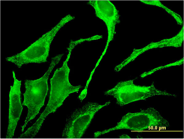 Immunofluorescence of monoclonal antibody to GALNT1 on HeLa cell . [antibody concentration 10 ug/ml]