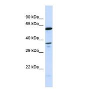 Western blot of Human HeLa. GALNT10 antibody dilution 1.0 ug/ml.
