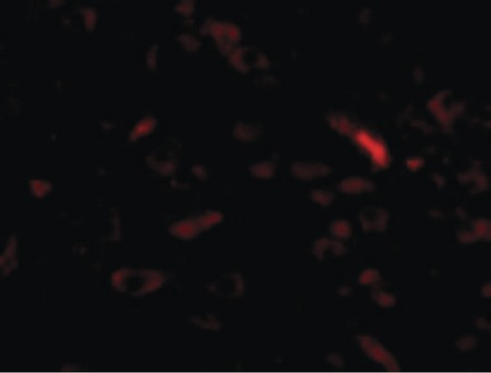 Immunofluorescence of GALNT10 in Human Brain cells with GALNT10 antibody at 20 ug/ml.