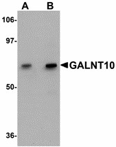 Western blot of GALNT10 in SK-N-SH cell lysate with GALNT10 antibody at (A) 1 and (B) 2 ug/ml.