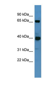 GALNT11 antibody LS-C135233 Western blot of Rat Heart lysate.