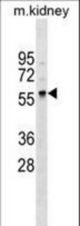 GLT11 Antibody western blot of mouse kidney tissue lysates (35 ug/lane). The GLT11 antibody detected the GLT11 protein (arrow).