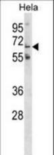 GLT11 Antibody western blot of HeLa cell line lysates (35 ug/lane). The GLT11 antibody detected the GLT11 protein (arrow).