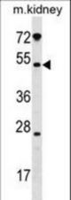 GALNT13 Antibody western blot of mouse kidney tissue lysates (35 ug/lane). The GALNT13 antibody detected the GALNT13 protein (arrow).