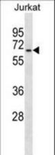 GALNT14 Antibody western blot of Jurkat cell line lysates (35 ug/lane). The GALNT14 antibody detected the GALNT14 protein (arrow).