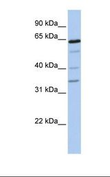 721_B cell lysate. Antibody concentration: 1.0 ug/ml. Gel concentration: 12%.