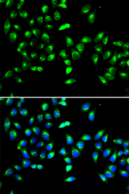 Immunofluorescence blot of HeLa cell using GALNT2 antibody. Blue: DAPI for nuclear staining.