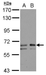 Sample (30 ug of whole cell lysate) A: NT2D1 B: IMR32 7.5% SDS PAGE GALNT2 antibody diluted at 1:1000