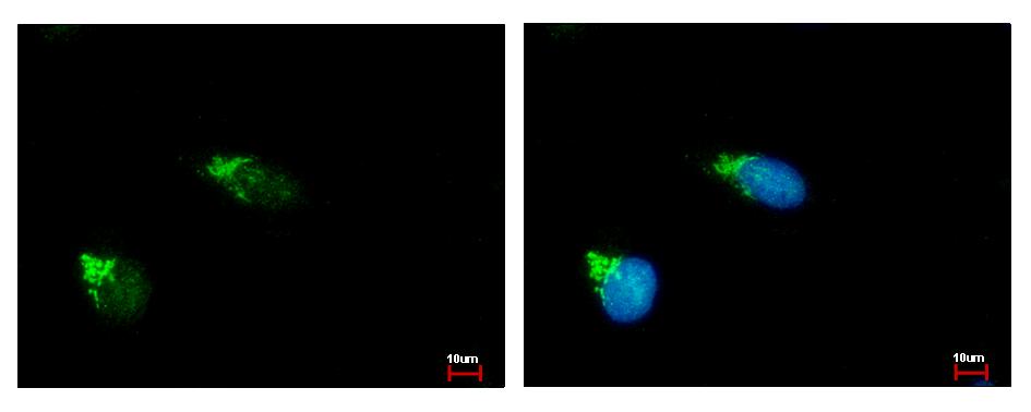 GALNT2 antibody [N1C1] detects GALNT2 protein at Golgi apparatus by immunofluorescent analysis. HeLa cells were fixed in ice-cold MeOH for 5 min. GALNT2 protein stained by GALNT2 antibody [N1C1] diluted at 1:500. 
