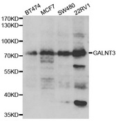 Western blot analysis of extracts of various cell lines, using GALNT3 antibody.