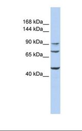 Hela cell lysate. Antibody concentration: 1.0 ug/ml. Gel concentration: 6-18%.