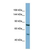 Western blot of Human COLO205. GALNT5 antibody dilution 1.0 ug/ml.