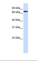 293T cell lysate. Antibody concentration: 1.0 ug/ml. Gel concentration: 12%.