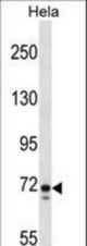 GALNT6 Antibody western blot of HeLa cell line lysates (35 ug/lane). The GALNT6 antibody detected the GALNT6 protein (arrow).