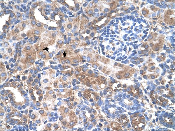 GALNT6 antibody LS-C80944 was used in IHC to stain formalin-fixed, paraffin-embedded human kidney.