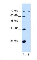 Lane A: HepG2 cell lysate. Antibody concentration: 5.0 ug/ml. Gel concentration: 12%.